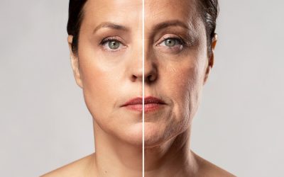 Embrace Timeless Beauty: A Guide to Reducing Wrinkles